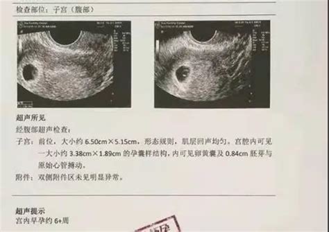 怀孕16周的胎儿有多大图片
