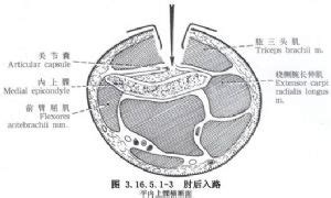 小头症介绍