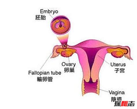 经常胚胎停育的原因有哪些