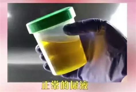 怀孕了尿液是什么样的颜色