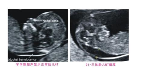 怀孕8周检查去哪个科室