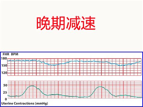 胎心慢保胎成功率高吗