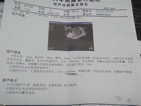 检查能不能怀孕需要检查哪个项目