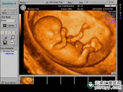 孕22周的宝宝四维彩超图片