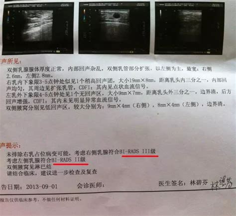 乳腺3类会恢复成1类吗