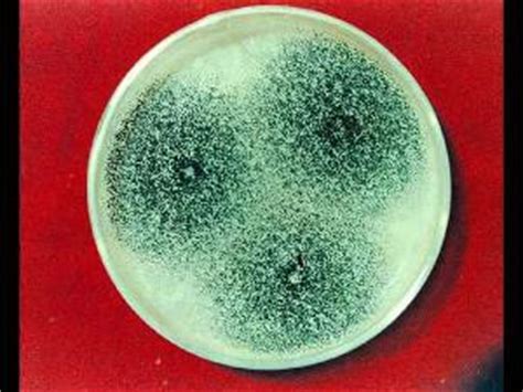孕期霉菌的症状图片