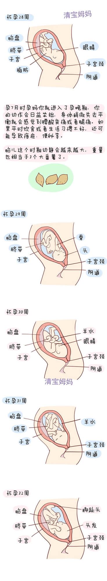 胎儿转头位是什么感觉