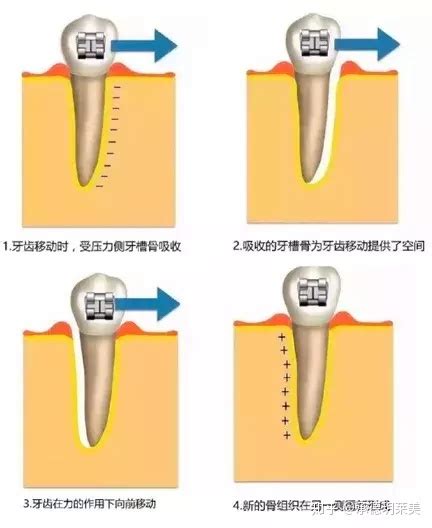 牙齿不好会遗传给宝宝吗