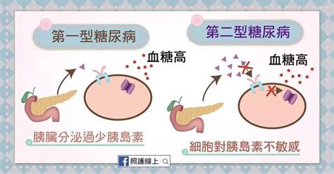四种情况是假性糖尿病