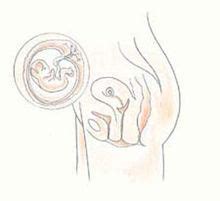 六个月胎儿胎心150