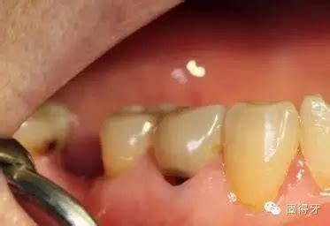 牙痛草图片专治虫牙