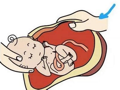 剖腹产之前孕妇要做哪些准备