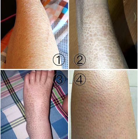 梦见红鱼生男还是生女