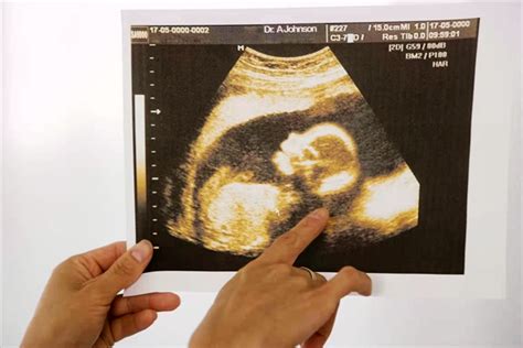 五大因素会困扰胎儿正常发育