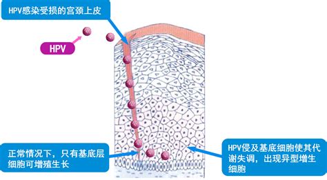 打完宫颈癌第一针后可以备孕么