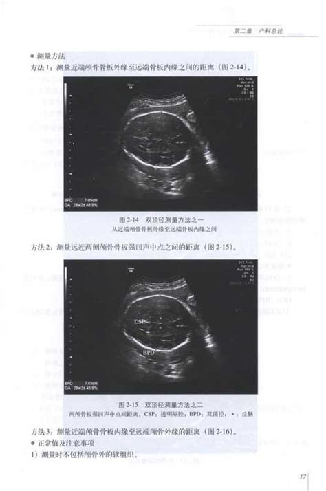 六大严重胎儿畸形