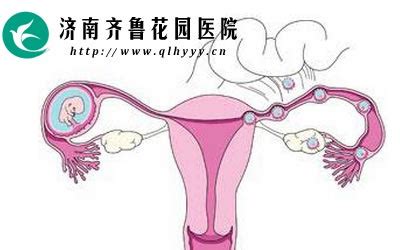 女性不孕的原因有很多输卵管堵塞