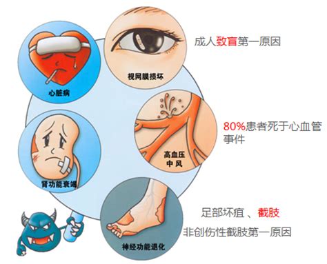 糖尿病的早期有7大表现