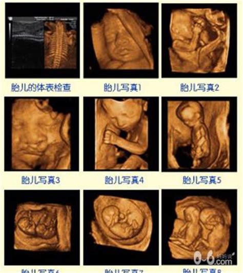 孕39周胎儿发育情况图