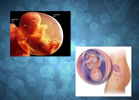孕期有什么征兆判断胎儿的性别