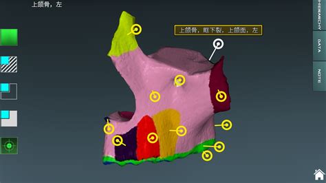 A.D.A.M互动解剖软件如何翻译成中文
