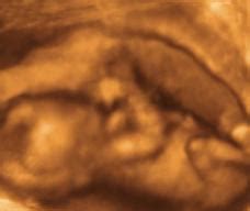 怀孕14周胎儿真实图片