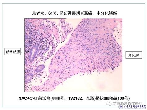 子宫后位大小5.1*5.2*3.4正常吗