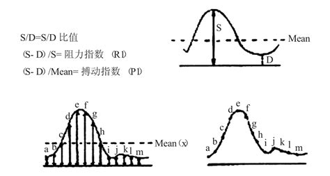 胎心監護曲線圖一條直線_手紋算命圖解生命線頭有一條橫線是什麼意思