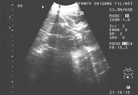 八周大的胎儿b超图片