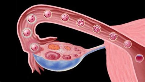 输卵管堵塞会导致宫外孕吗?