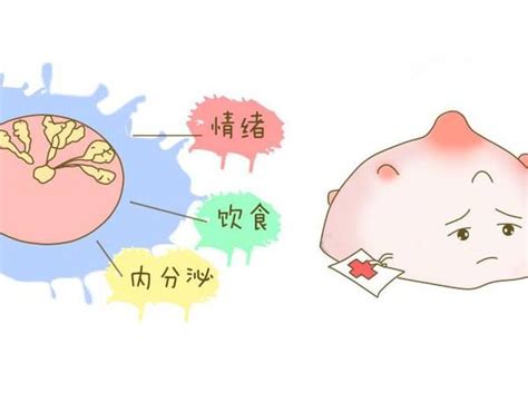 与月经周期有关的乳房胀痛