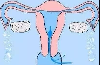 女性输卵管堵塞会排卵吗