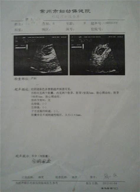 怀20天双胞胎的b超图片