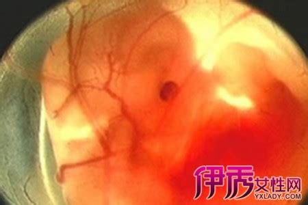 怀孕4个月胎儿的发育情况