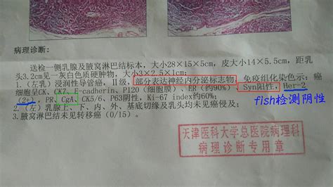 hpv16阳性是什么意思