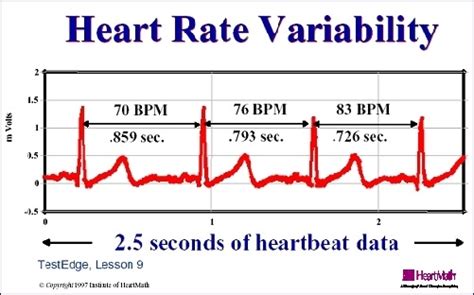 心率变异TP是什么意思,我的心电图显示TP改变