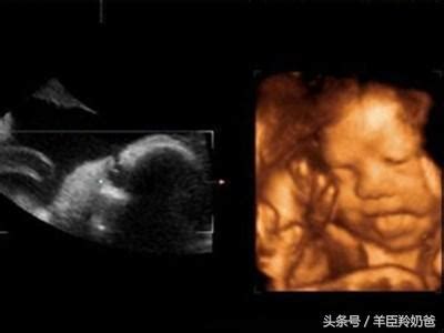 22周双胞胎做四维图片