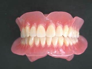 假牙分几种哪种最好