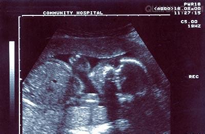 怀孕三个月胎儿最怕什么