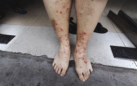 家里有跳蚤怎么办,鸡窝里的跳蚤怎么灭 - 元马网