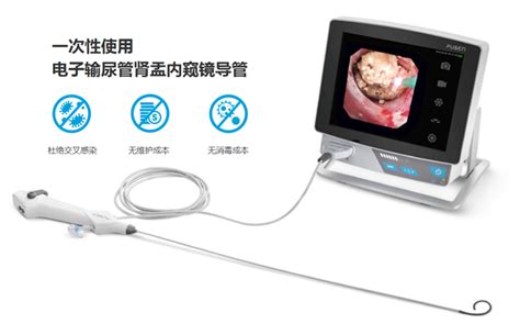 输尿管软镜碎石费用