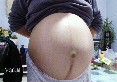 怀二胎四个月胎动少正常吗
