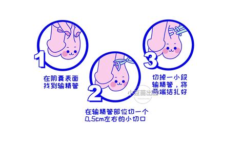 男性结扎手术能看见刀口吗