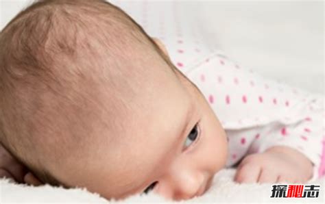 36周出生的新生儿用做眼底筛查吗