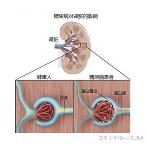 尿毒症磷不高为什么全身痒