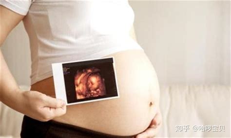 超声检查胎儿左足姿势异常