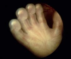 胎儿听到噪音胎动频繁