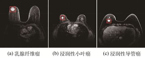 老狗乳腺肿瘤能活多久