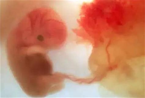怀孕14周胎儿图片说明