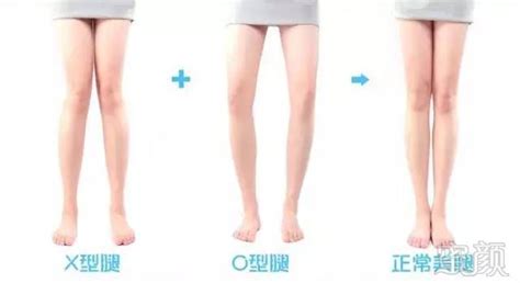 寶寶坐學(xué)步車(chē)好嗎真的會(huì)造成O型腿嗎